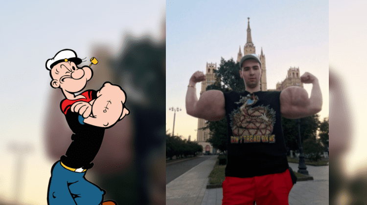 Tânărul cu bicepși gigantici a recunoscut că a făcut o prostie. A suferit prima intervenție chirurgicală!