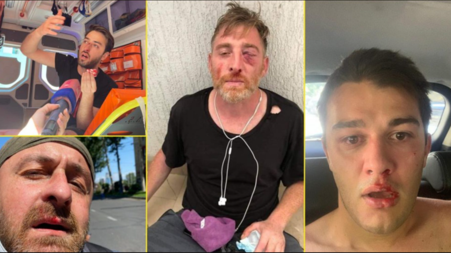 Peste 20 de jurnaliști au fost bătuți de oponenții marșului Pride, la Tbilisi. Jurnalist: „Au vrut să mă omoare”