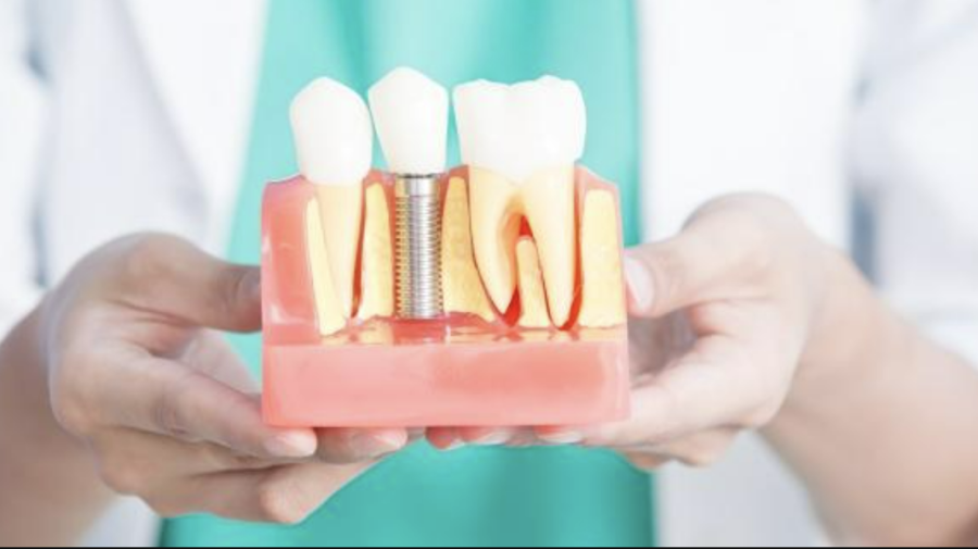 FOTO Am trăit s-o vedem și pe asta! Un lot de implanturi dentare urma să ajungă ilegal în Moldova