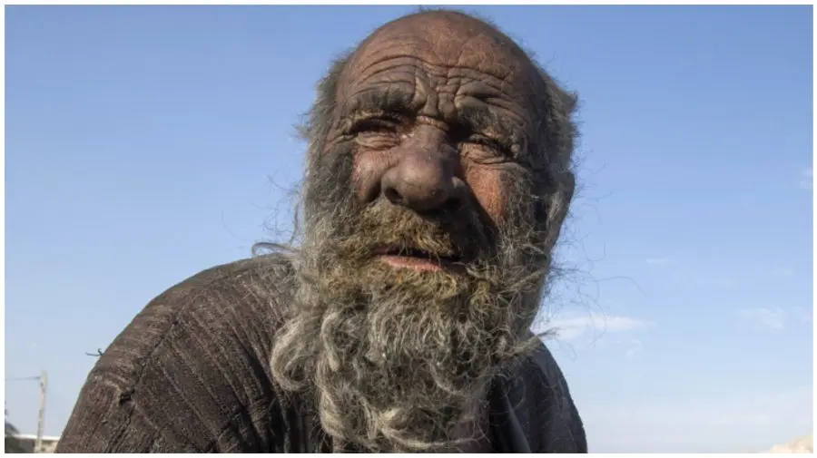 FOTO Ironia sorții. „Cel mai murdar om din lume”, care nu s-a spălat 50 de ani a murit după ce a făcut baie