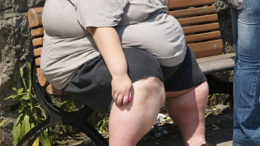 Statistică: Aproape 1 din 4 moldoveni are probleme de obezitate