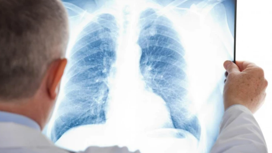 Cetățenii din raionul Ialoveni pot beneficia de screening pulmonar gratuit. Unde trebuie să se adreseze