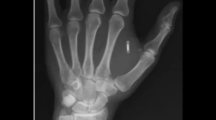Experiment cu final neașteptat. Un magician a uitat parola cipului implantat în mână