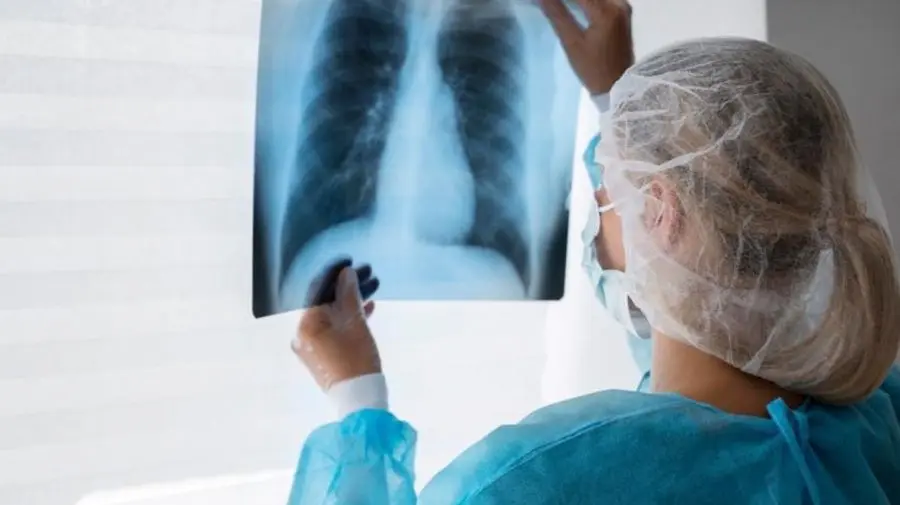 Crește numărul cazurilor de tuberculoză în Capitală. Numărul pacienților diagnosticați într-o săptămână