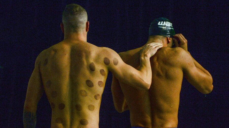 GALERIE FOTO De ce unii sportivi de la Jocurile Olimpice au pe corp niște pete rotunde ca niște vânătai?