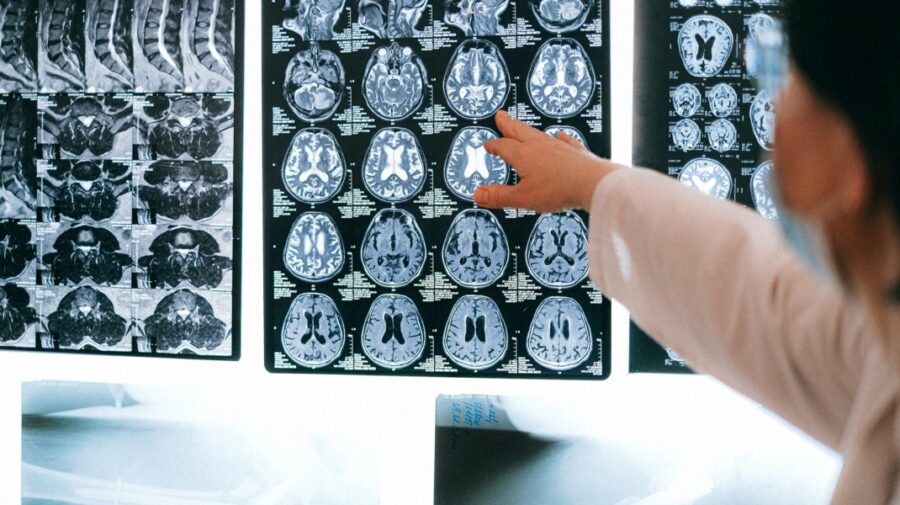 Cercetătorii vor să „inunde” creierul uman cu microcipuri: Ce boli ar putea trata?