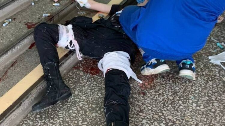 UPDATE FOTO +18! Atacatorul de la universitatea din Perm ar fi viu. Acesta este internat în spital în stare gravă
