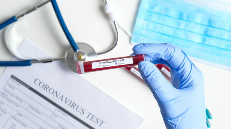 Ministerul Sănătății vine cu precizări în legătură cu testele PCR de 300 de lei pentru COVID-19