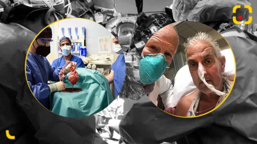 FOTO, VIDEO Om cu inimă de porc! Primul pacient din lume căruia i-a fost transplantat un astfel de organ de animal
