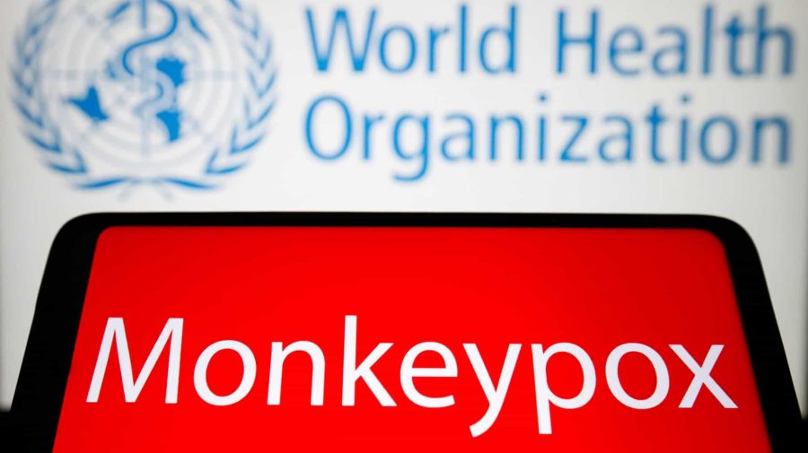 Organizaţia Mondială a Sănătăţii consideră că nu există motive de îngrijorare: Variola maimuței nu se compară cu COVID