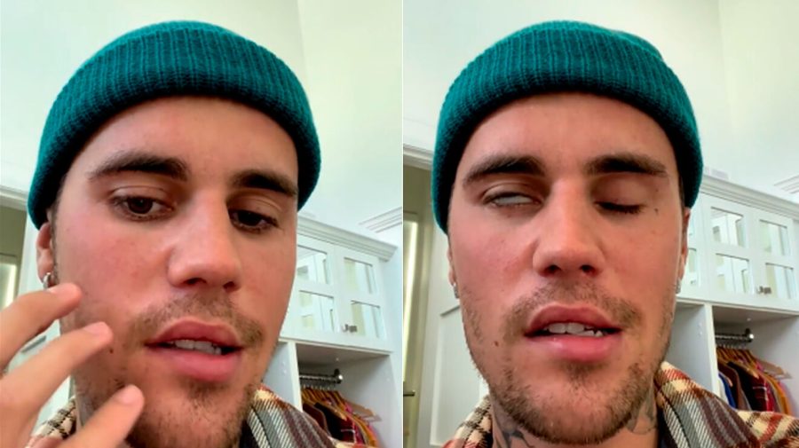 VIDEO Imagini șocante cu Justin Bieber. Un virus i-a afectat nervii de la ureche și l-a lăsat paralizat jumătate de față