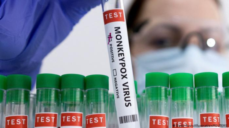 Date îngrijorătoare de la Ministerul Sănătății din România! Al patrulea caz de variola maimuței a fost confirmat