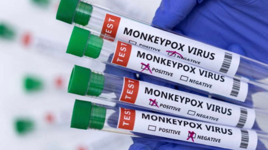 Date îngrijorătoare de la OMS: 14.000 de cazuri și cinci decese de variola maimuței la nivel global