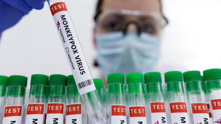Un nou caz de variola maimuţei, confirmat în România. Ultimele cazuri au fost în august