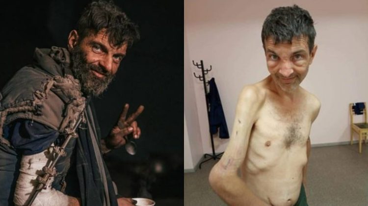 GALERIE FOTO Schilodit și desfigurat: Cum s-a întors acasă Mihail Dianov, celebrul luptător de la Azovstal