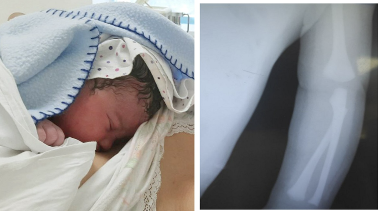 VIDEO Un bebeluș din Bălți s-a ales cu mâna fracturată la naștere. Părinții acuză medicii de malpraxis
