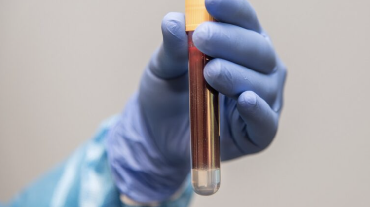 Au început primele transfuzii cu sânge creat în laborator. În ce cazuri ar putea fi utilizat