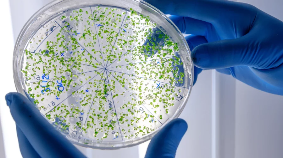 Raport ONU: Superbacteriile reprezintă un risc global pentru sănătate