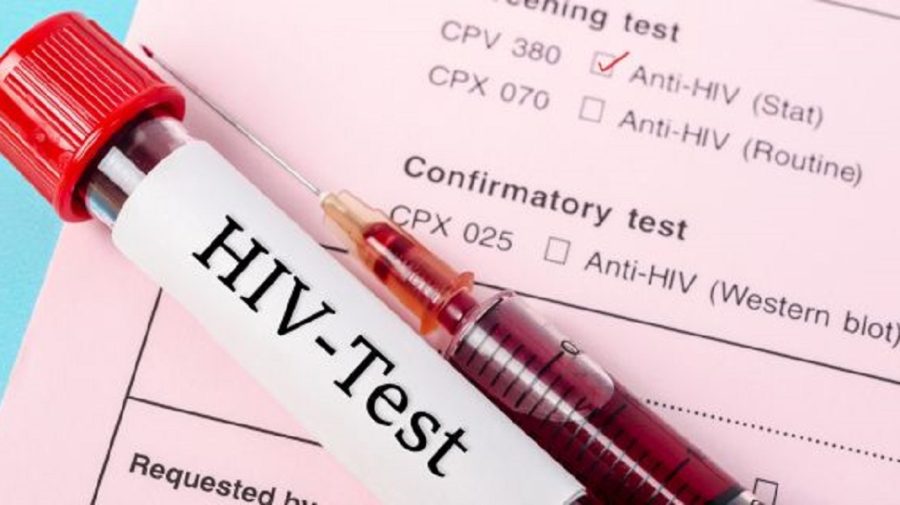 Reducerea ajutorului extern de către țările occidentale ar putea duce la 3 milioane de decese cauzate de HIV