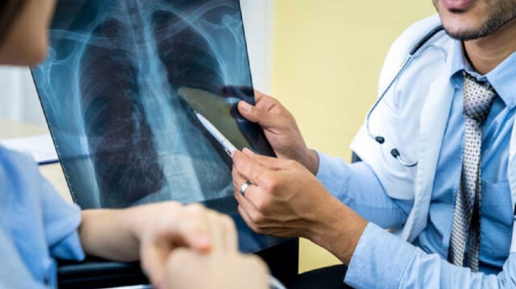 FOTO Caz șocant! O femeie credea că are TBC, dar medicii i-au găsit un prezervativ în plămâni