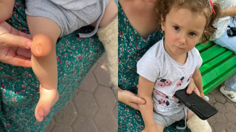 FOTO, VIDEO Povestea plină de durere a unei mame care cerșea pentru operațiile fetiței. Familia trăiește în chirie