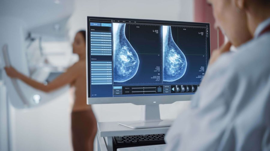 Creștere alarmantă a cancerului mamar în Republica Moldova: Rata depistării tardive rămâne ridicată