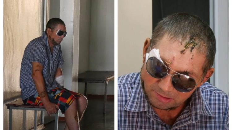 VIDEO Bărbatul din Baimaclia, mutilat de câini, se confruntă cu grave probleme de sănătate. Ce povestește