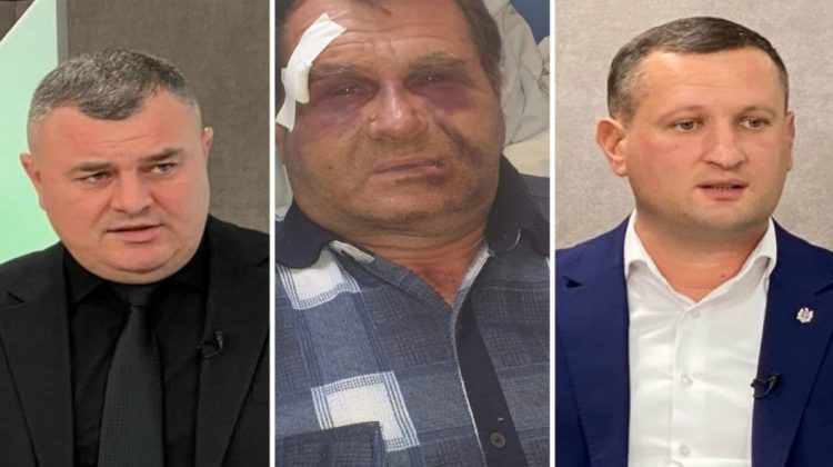 VIDEO Grigore Novac: Omul stă bătut măr în traumatologie. I-au rupt coastele! Cheptonar: Cred că este o minciună!