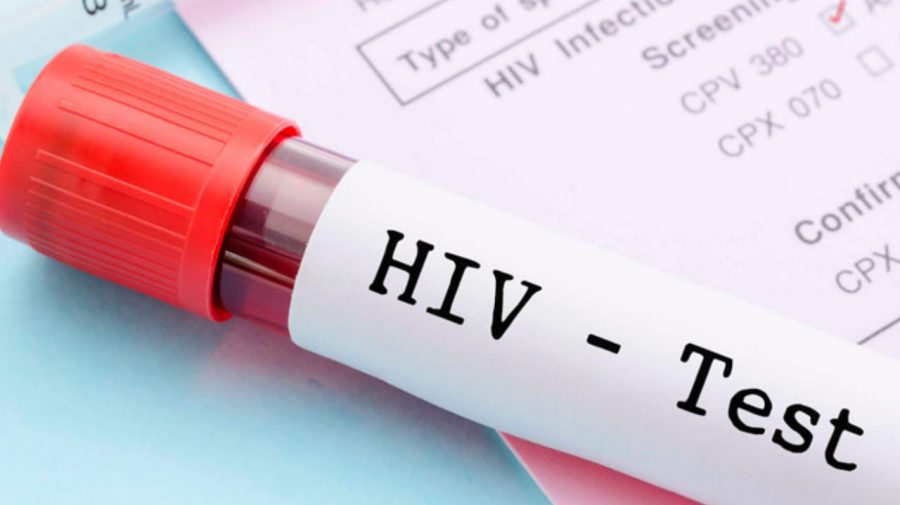 Ziua Mondială de luptă împotriva HIV/SIDA. În 2022, peste 630 mii de persoane au decedat din cauze legate de HIV