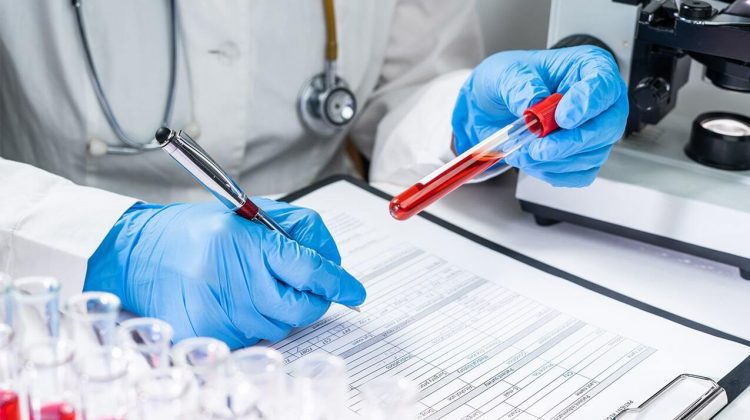 Primul test de sânge din lume pentru depistarea cancerului cerebral poate creşte rata de supravieţuire