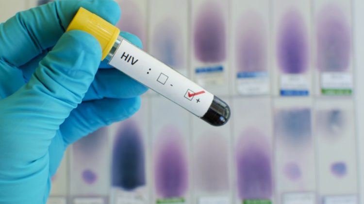 Descoperire revoluționară: Oamenii de știință au eliminat „cu succes” HIV din ADN