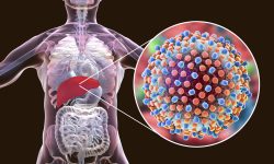 Virusurile hepatice provoacă în continuare 3.500 de decese pe zi, avertizează OMS