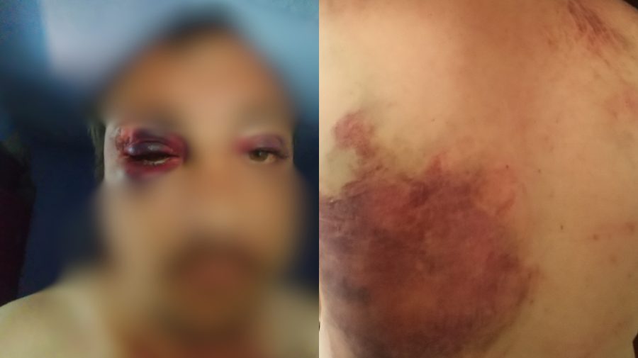 FOTO cu impact emoțional! Un bărbat din Leova susține că ar fi fost agresat și jefuit în stradă de mai mulți indivizi