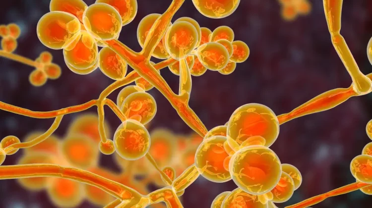 Ciuperca rezistentă care se răspândește rapid în Europa – simptomele infecției cu Candida Auris