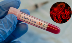 Epidemia de Ebola se extinde exponențial în Congo: Peste 2.500 de oameni au murit