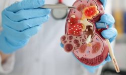 Un nou serviciu medical la Ungheni: Pacienții pot consulta medicul nefrolog