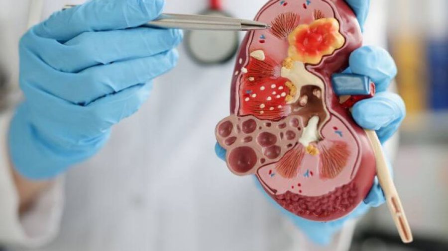 Un nou serviciu medical la Ungheni: Pacienții pot consulta medicul nefrolog