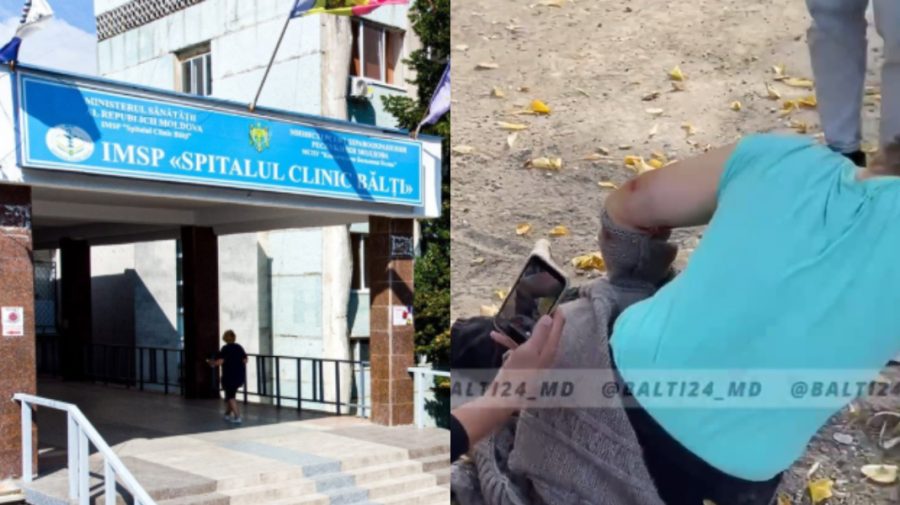 Care este starea femeii atacată de un câine la Bălți